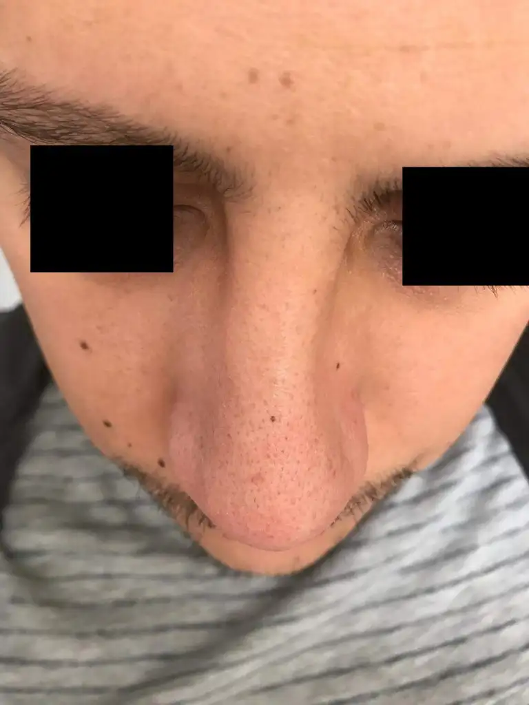 Görsel 1.webp