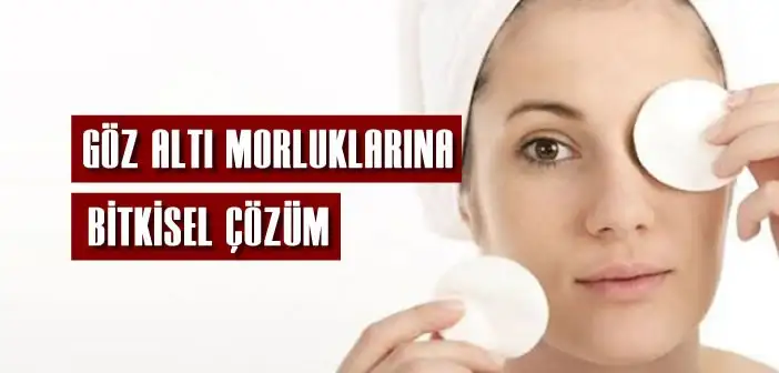 goz-alti-morluklarina-bitkisel-cozum-702x336.webp