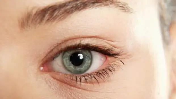 goz_alti_kirisikliklari_nasil_gecer_ne_iyi_Gelir.webp