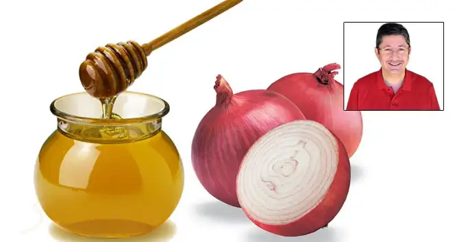 gribe-ve-faranjite-dogal-cozum-922280-664x354.webp