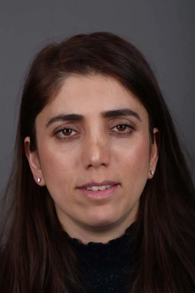 Gülşah AKYOL Preop 26012019 (2).webp