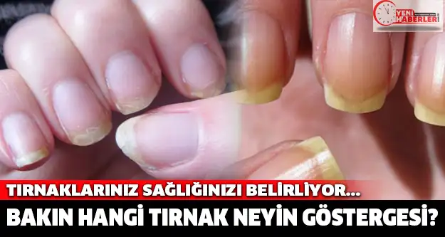 hangi_tirnak_neyin_gostergesi_ (1).webp