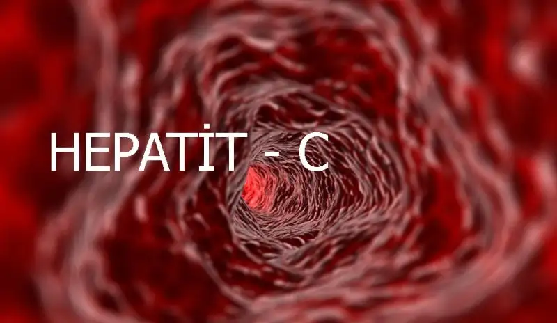 hepatitc.webp