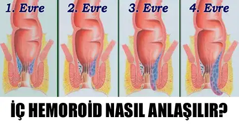 adetliyken kocamı nasıl rahatlatılır