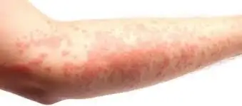 içerik.webp