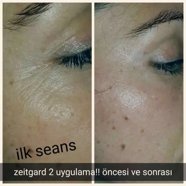 xx sek