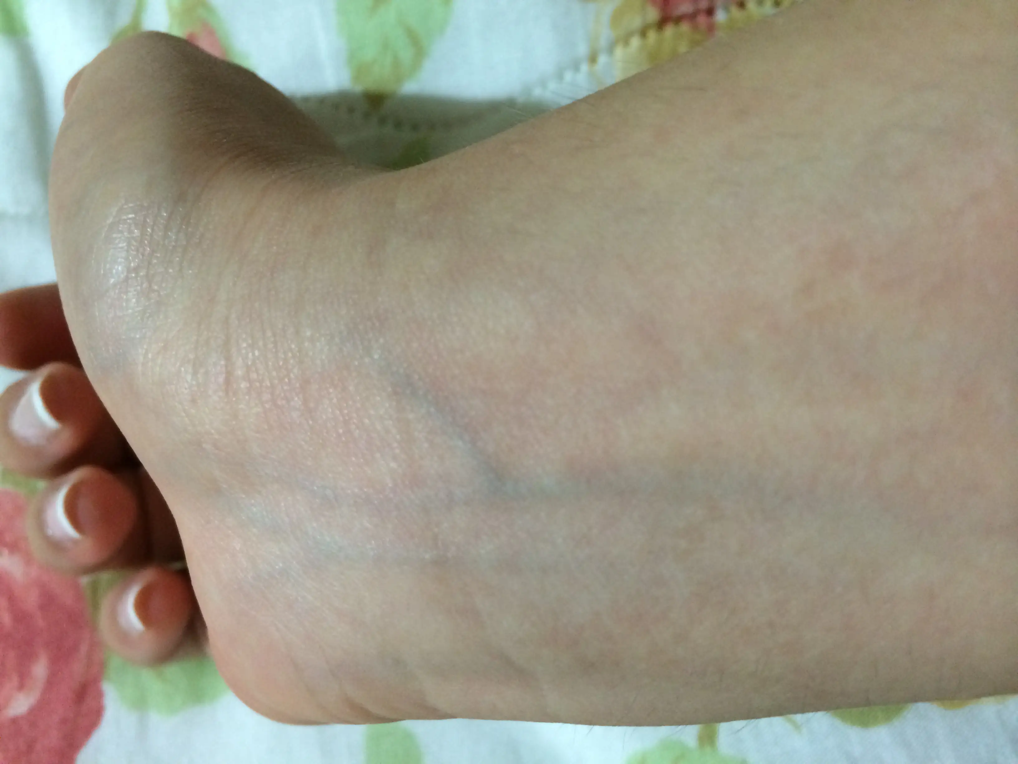 image.webp