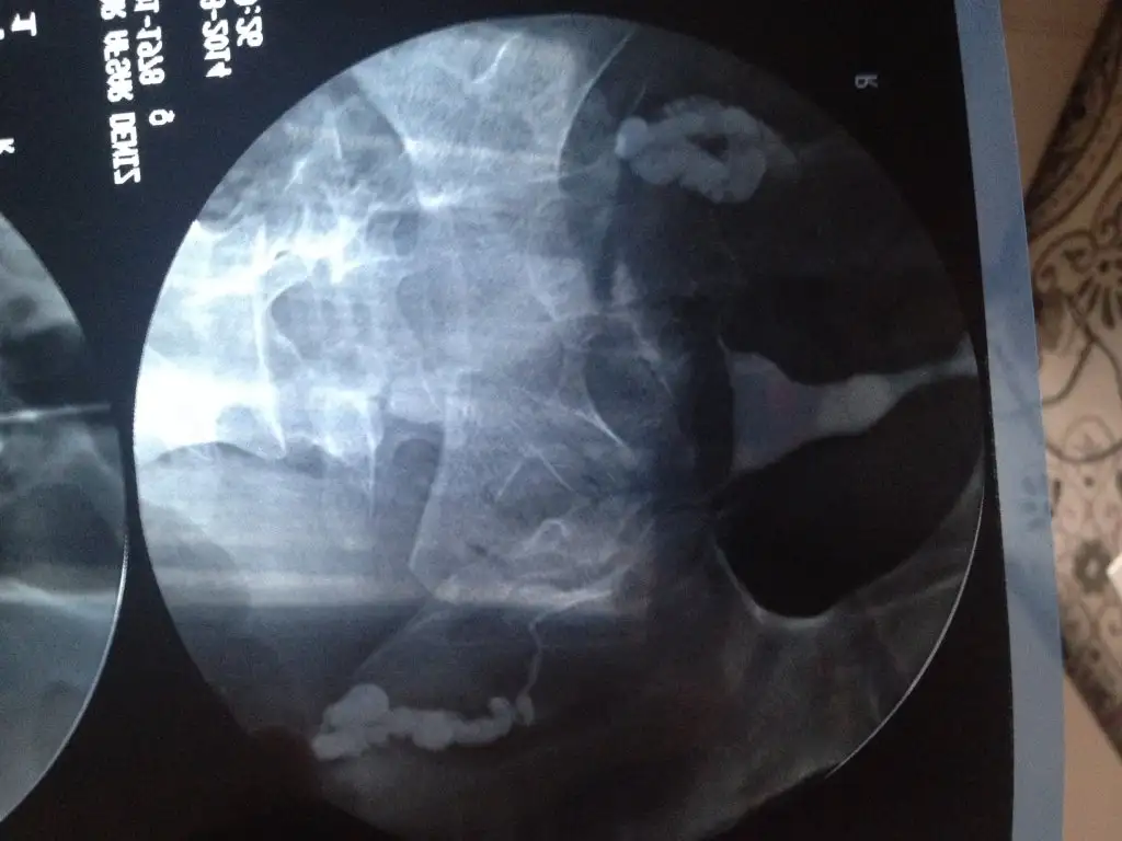 image.webp