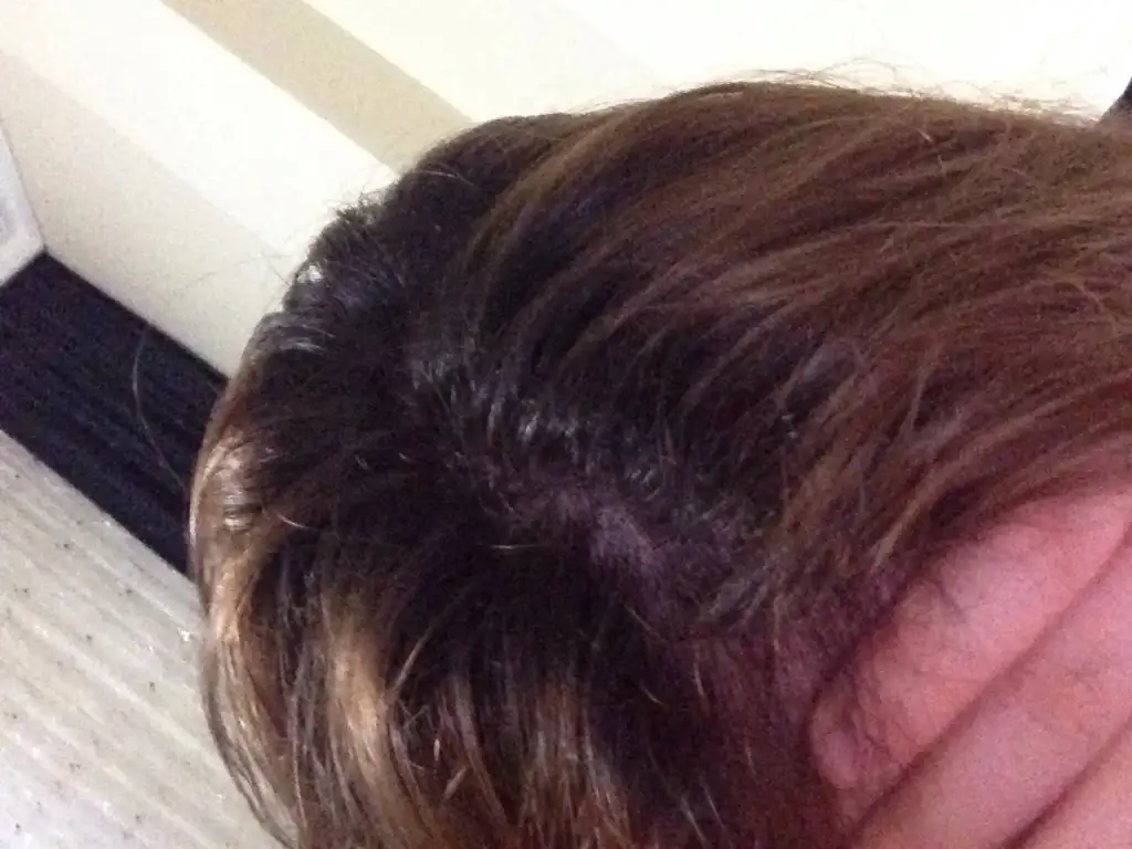image.webp