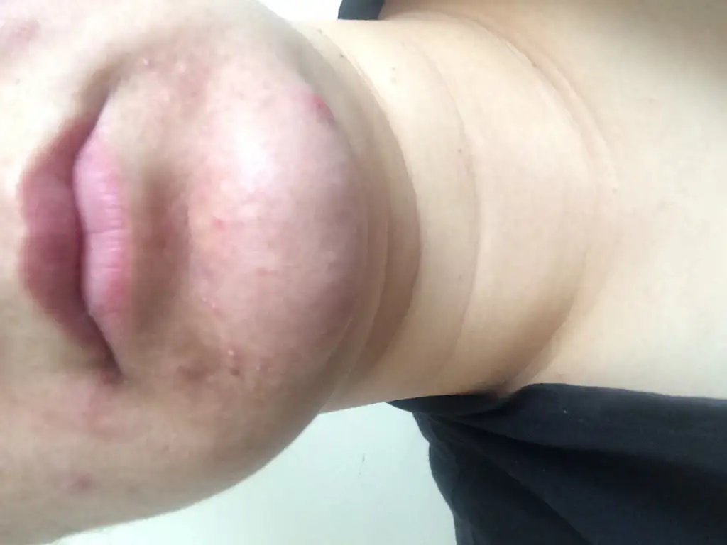 image.webp