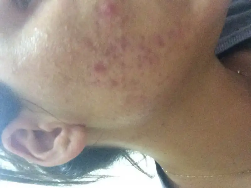 image.webp