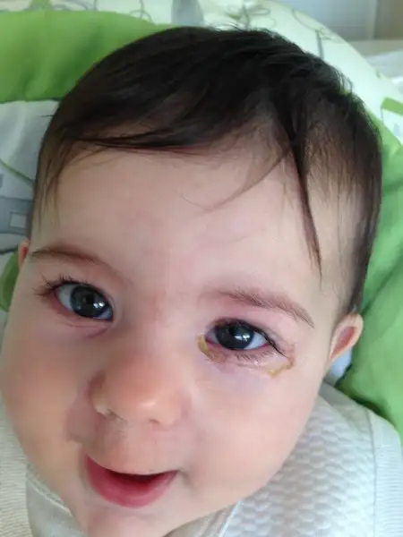 image.webp