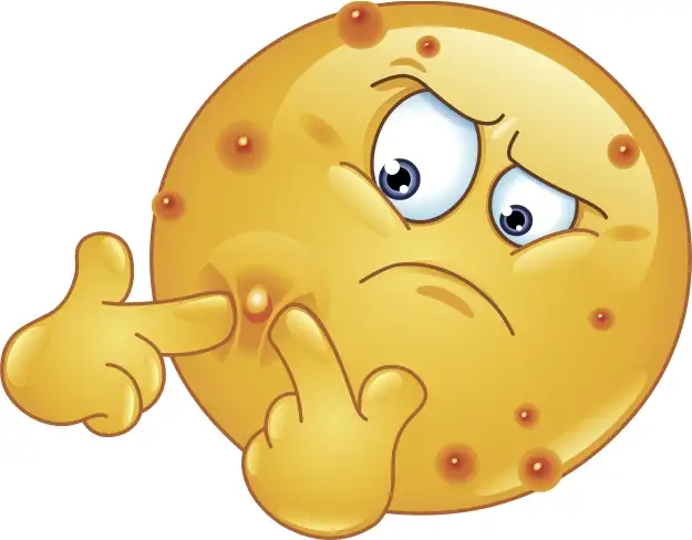 image.webp
