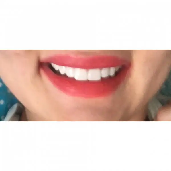 image.webp