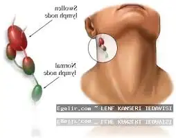 images.webp