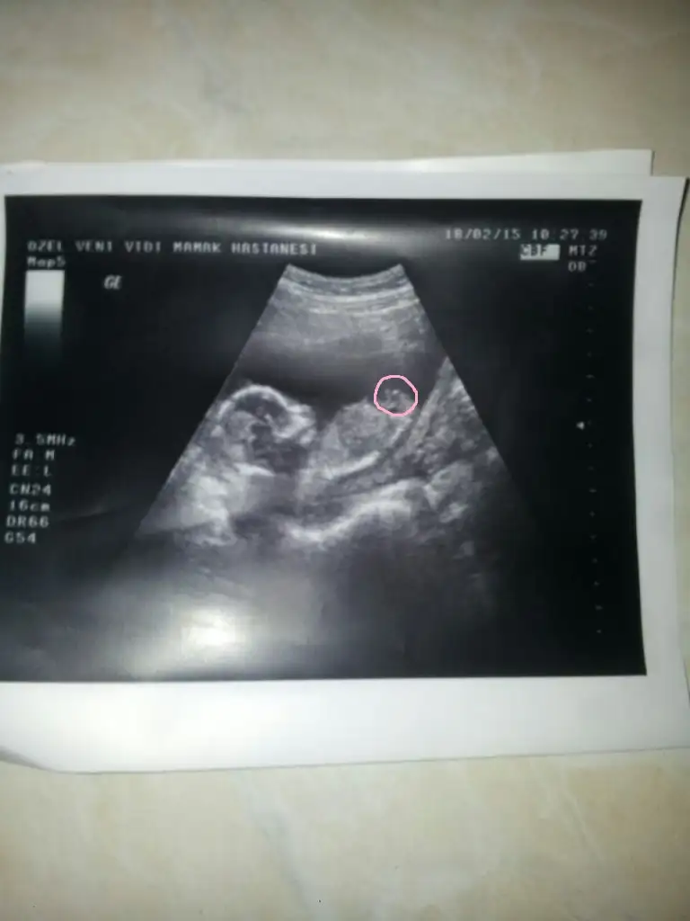 IMG-20150227-WA0011.webp