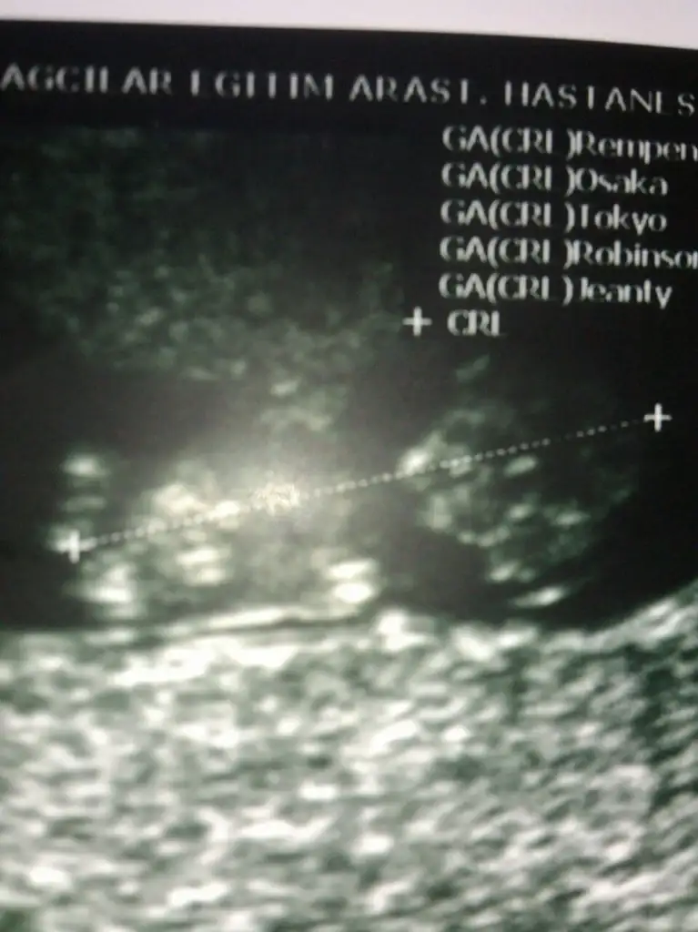 IMG-20150305-WA0011.webp