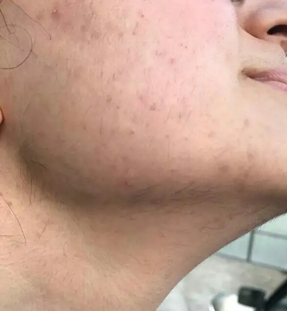 IMG-20190330-WA0007-1-1.webp