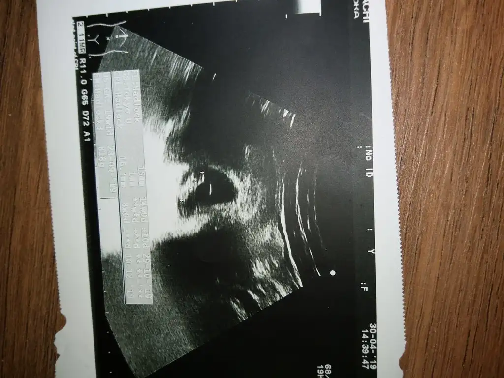 IMG-20190601-WA0002.webp
