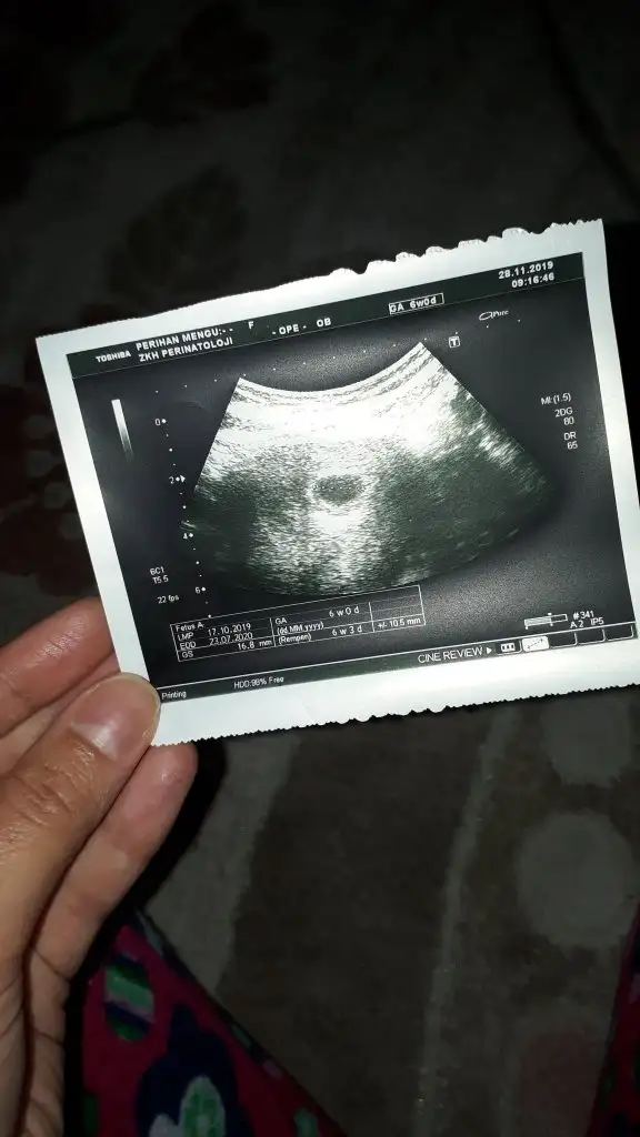 IMG-20191128-WA0005.webp