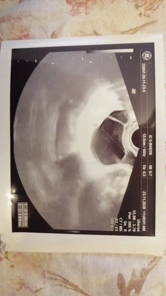 IMG-20201123-WA0006.jpeg