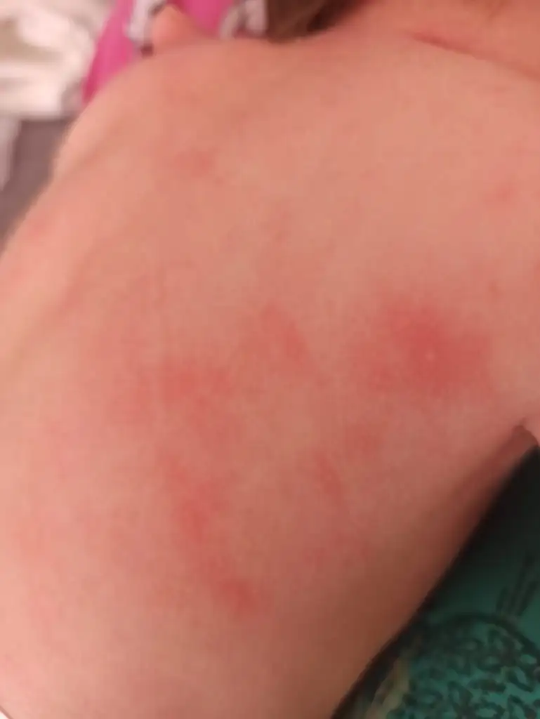flu izle
