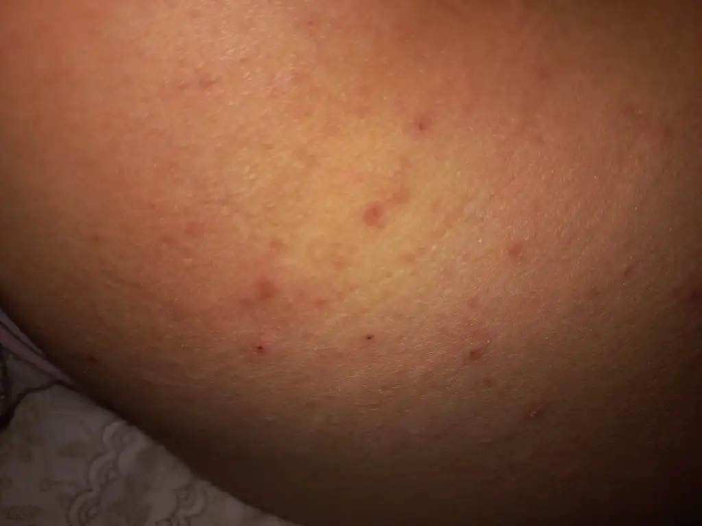 IMG-20221229-WA0006.webp