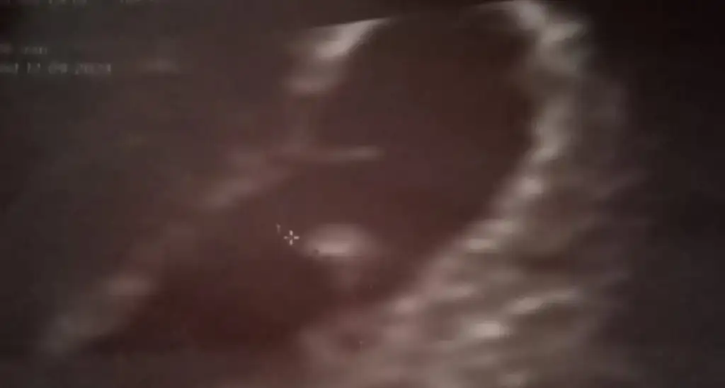 IMG-20230116-WA0034.webp
