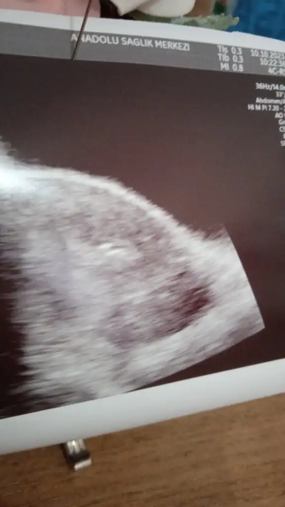 IMG-20231010-WA0002.webp