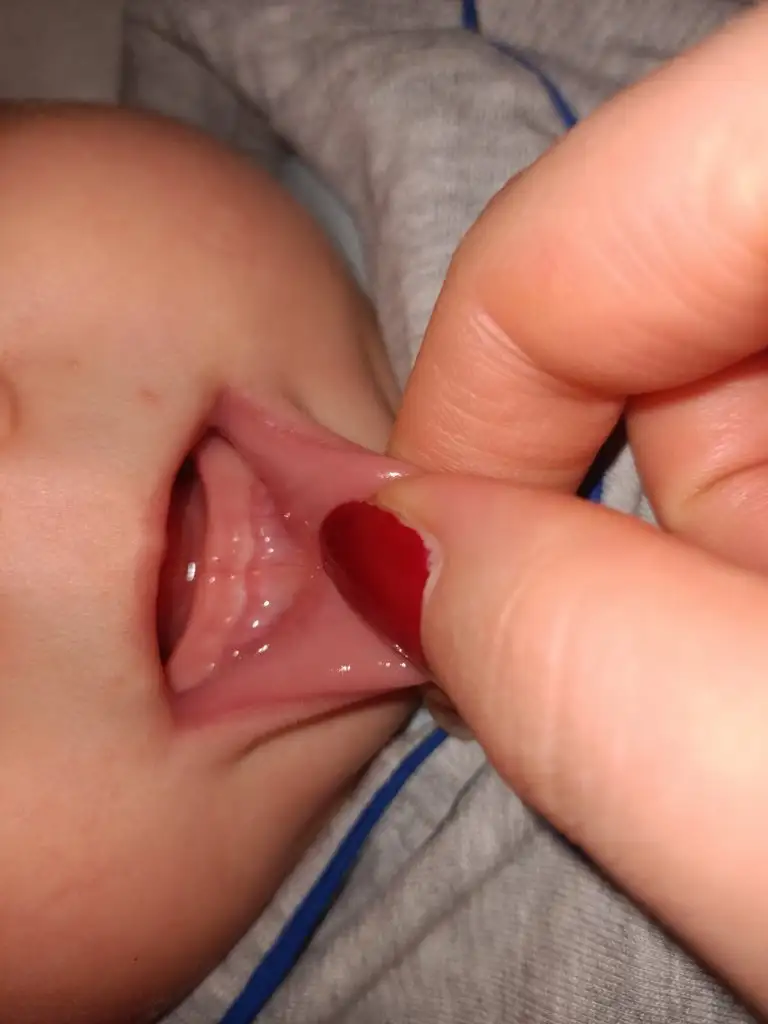 IMG20220216201101.webp