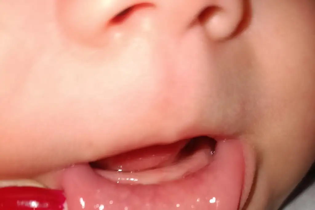 IMG_20220216_201407.webp