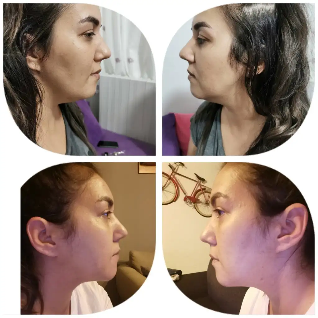 inCollage_20200927_230045302.webp