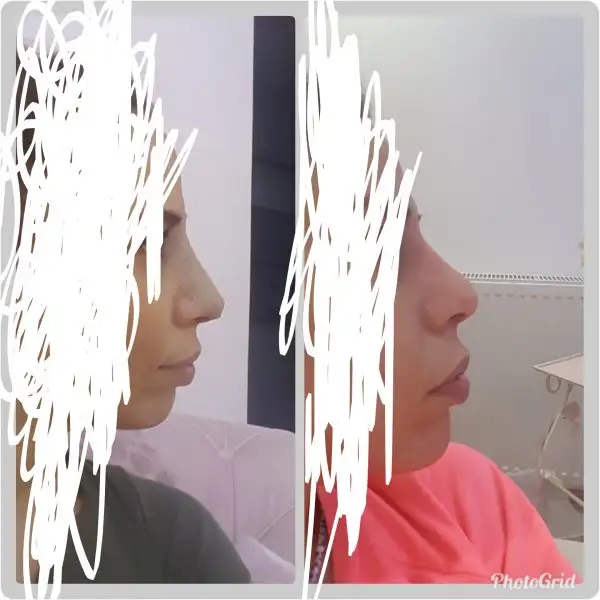 InkedPhotoGrid_1511203293262_LI.webp