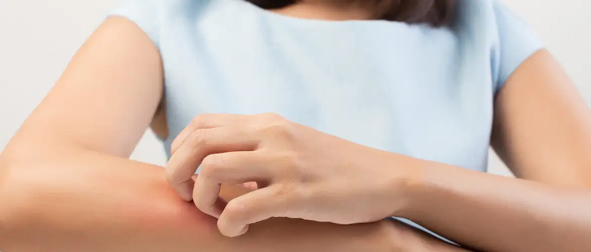 inpage-article-skinailments.webp