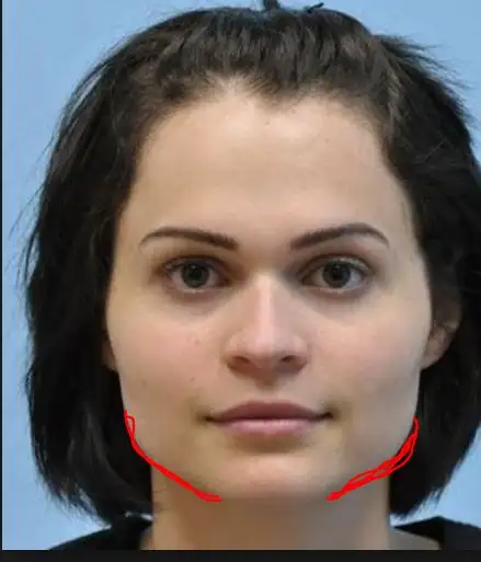 jaw.webp