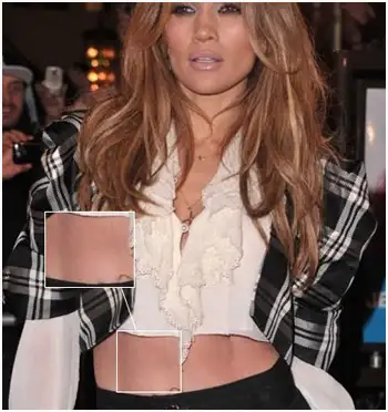 Jennifer-Lopez-belly-stretch-marks.webp
