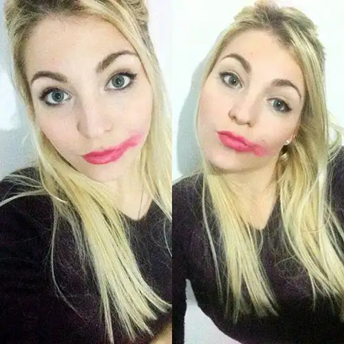 kanser_ruj (5).webp
