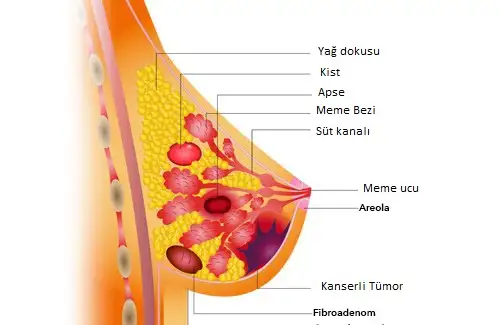 Kanseri-önleme.webp