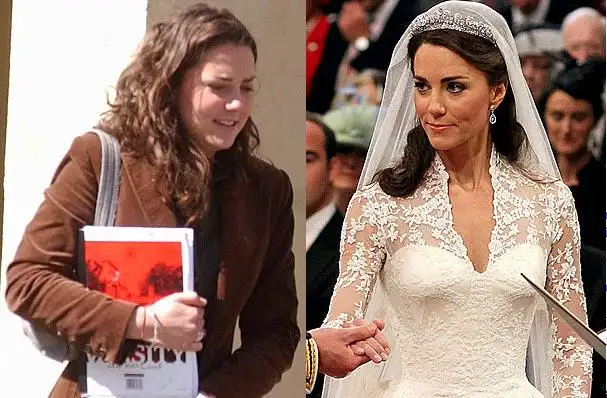 kate-middleton-before-after-beauty-treatments-wedding.webp