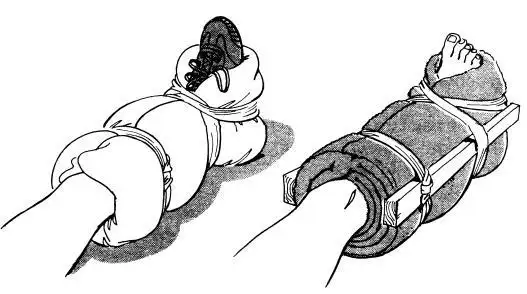kirik-cikik-burkulma.webp
