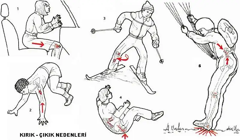 kiriknedeni.webp
