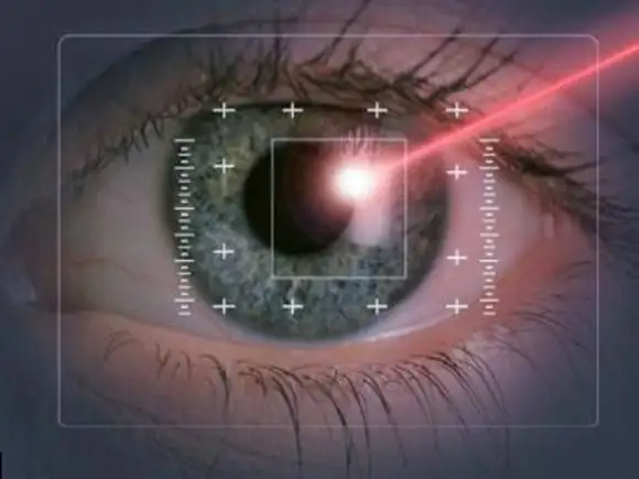 lazer-goz-tedavisi-2.webp
