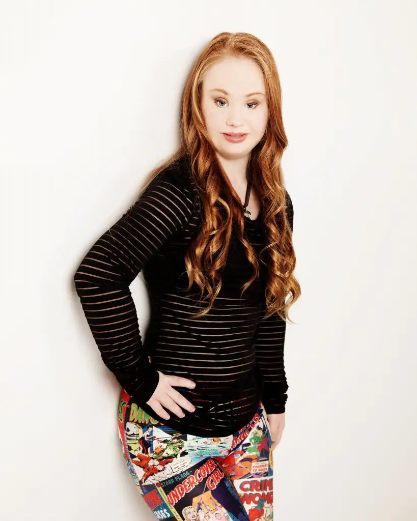 Madeline-Stuart-Model-Down-Syndrome (2).webp