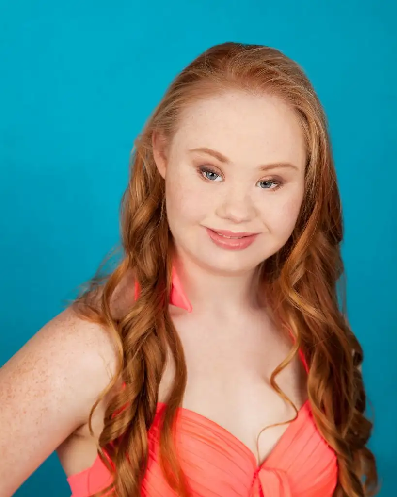 Madeline-Stuart-Model-Down-Syndrome (3).webp