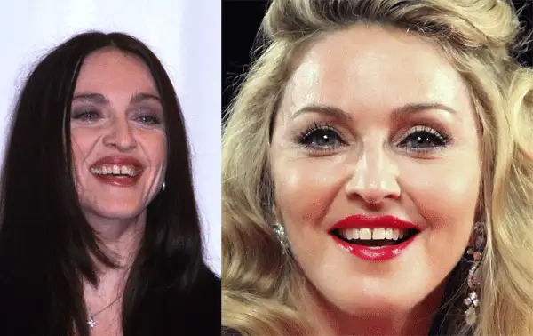Madonna.webp