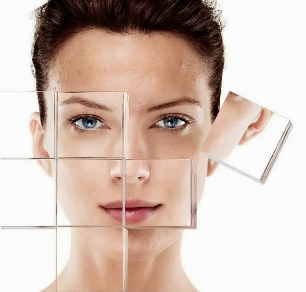 Mixto_Laser_Resurfacing-lazer-ile-cilt-yenileme1.webp