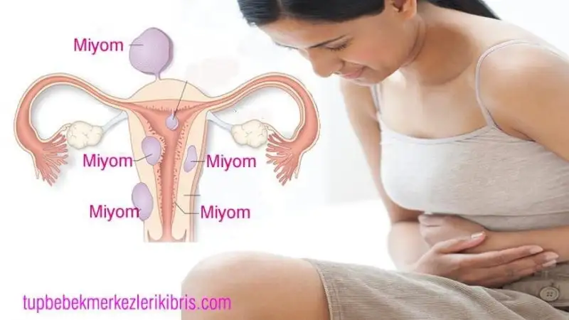 miyom-konusuna resim!.webp