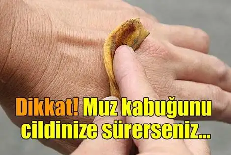 muz_kabugu_cilt.webp