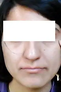 n.webp