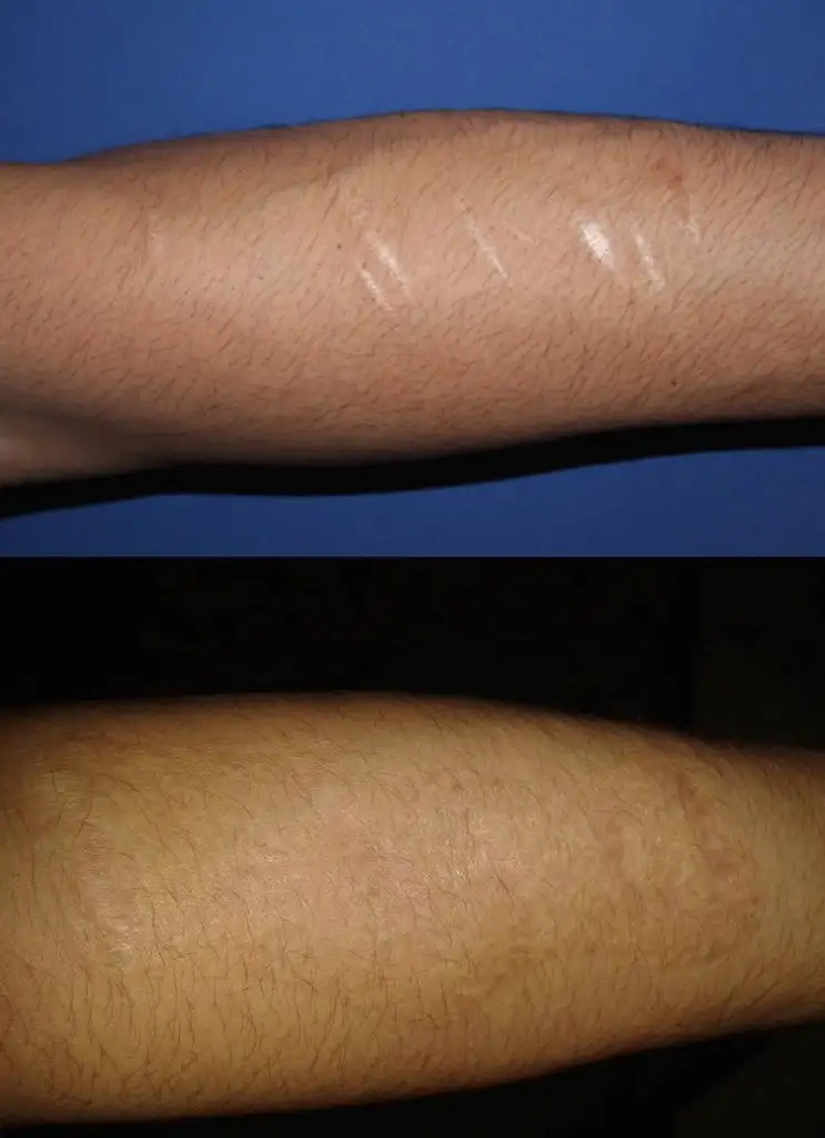 oÌˆnkol 15 ay.webp